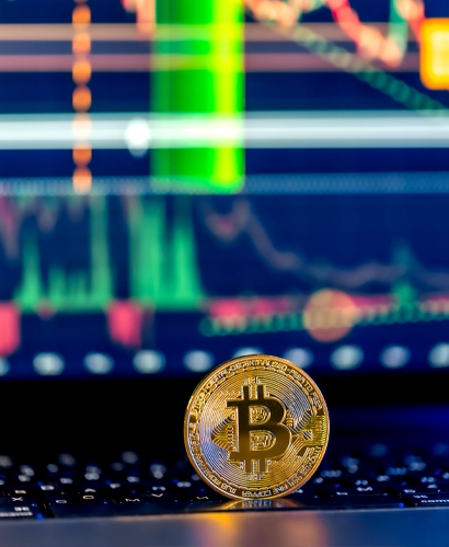 Equipo de Vision Avapro 300